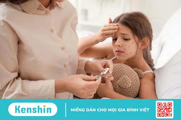 10 nguyên nhân sốt phát ban phổ biến ở trẻ em cần lưu ý