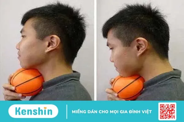 3 cách giảm nọng cằm siêu đơn giản cho khuôn mặt thanh thoát