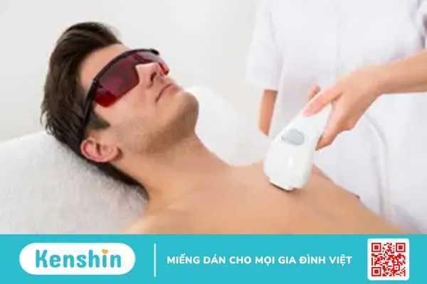 3 cách tẩy lông ngực dành cho các Adam