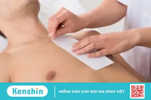 3 cách tẩy lông ngực dành cho các Adam