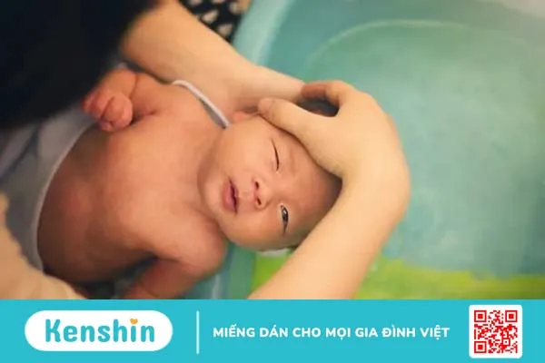4 cách đơn giản giúp bạn chăm sóc rốn cho trẻ sơ sinh 4 cách đơn giản giúp bạn chăm sóc rốn cho trẻ sơ sinh