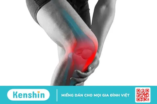 4 triệu chứng sưng, nóng, đỏ, đau tại khớp nói lên điều gì?