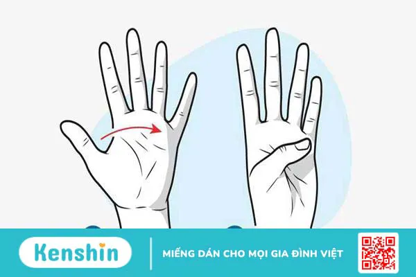 5 bài tập giúp giảm cứng khớp ngón tay hiệu quả