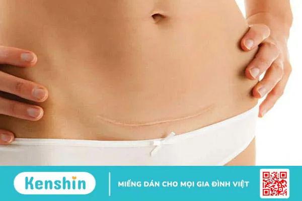 5 loại nhiễm trùng sau khi sinh bạn nên biết