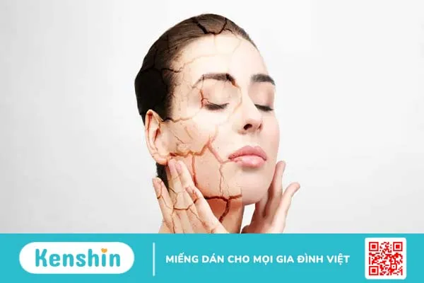 5 quy tắc chăm sóc da dầu mụn mà bạn nên biết!