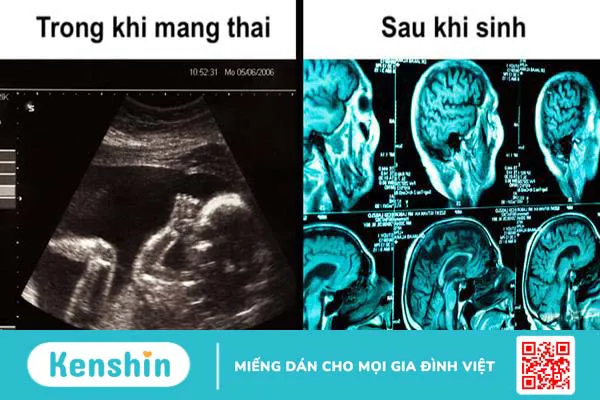 7 thay đổi của phụ nữ sau sinh bạn nên biết