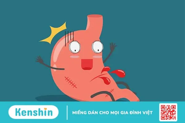 9 trường hợp cần lưu ý khi dùng thuốc giảm đau kháng viêm