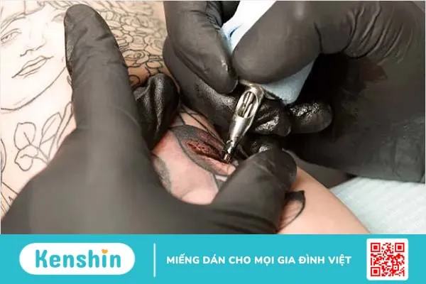 9 vấn đề thường gặp khi xăm hình và cách khắc phục hiệu quả