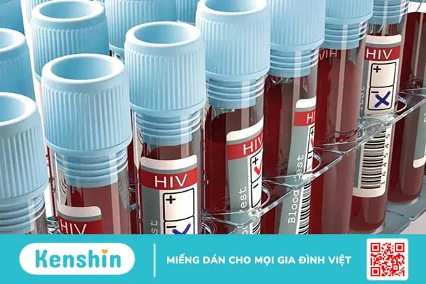 AIDS là gì? HIV là gì? Nguyên nhân, dấu hiệu, cách phòng ngừa