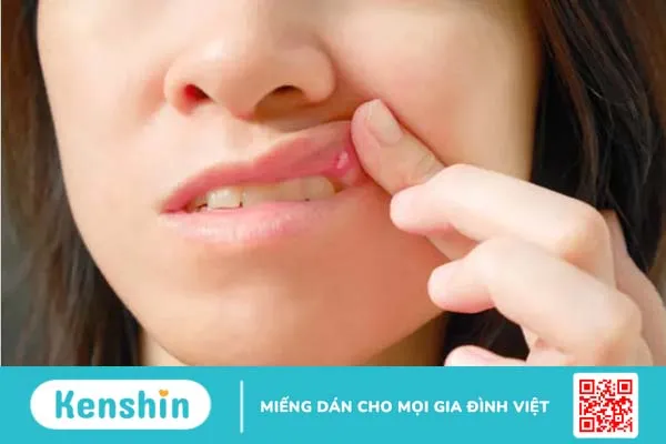 Ăn chôm chôm có tác dụng gì? 13 lợi ích của chôm chôm đối với sức khỏe