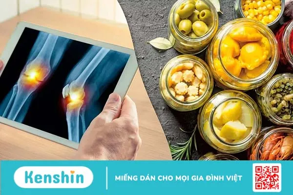 Ăn chua nhiều có tốt không? 8 tác hại khôn lường làm bạn giật mình