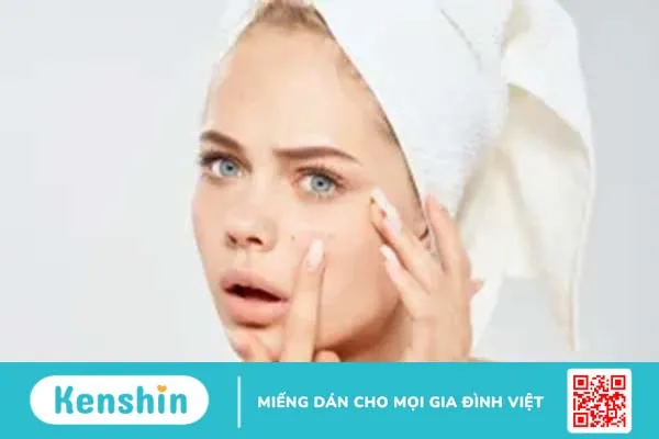 Azelaic Acid là gì? Thần dược trị mụn, mờ thâm ít ai biết