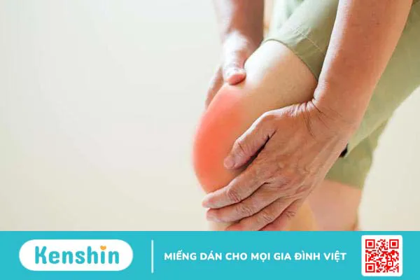Bạn biết gì về bệnh tràn dịch khớp gối?