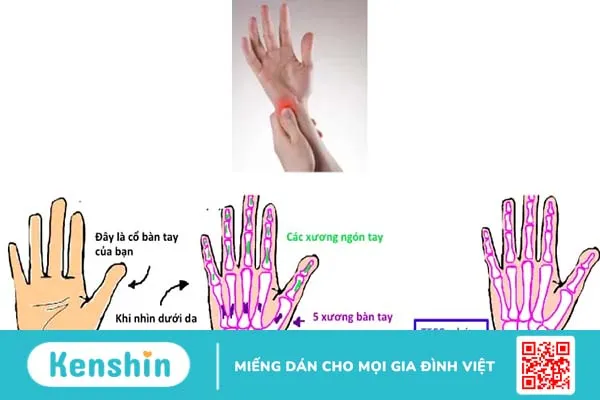 Bạn biết gì về đau cổ tay bên trụ?