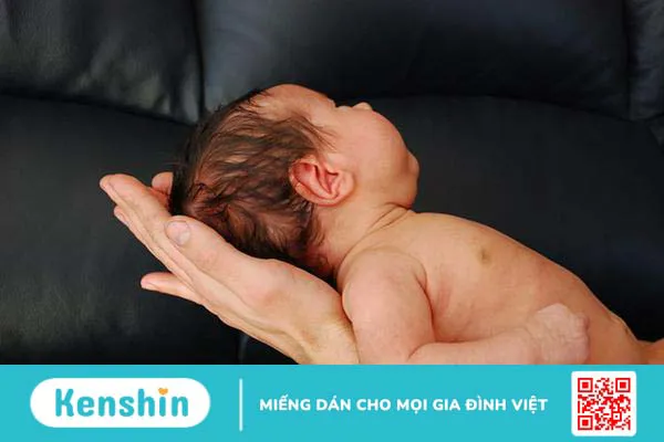 Bạn có biết thóp trẻ sơ sinh như thế nào là bình thường, thế nào là đáng lo?