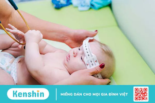 Bạn có biết thóp trẻ sơ sinh như thế nào là bình thường, thế nào là đáng lo?