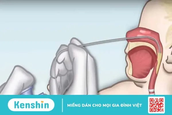 Bật mí 5 cách rửa mũi cho trẻ sơ sinh vừa nhanh vừa hiệu quả