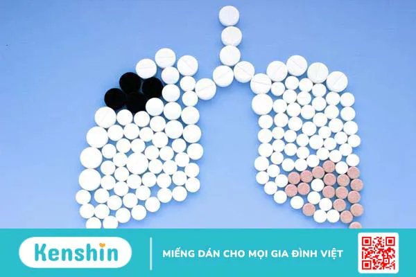 Bật mí các cách điều trị viêm phổi giúp bạn nhanh khỏe