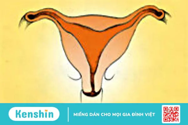 Bất thường ở tử cung ảnh hưởng đến khả năng sinh sản