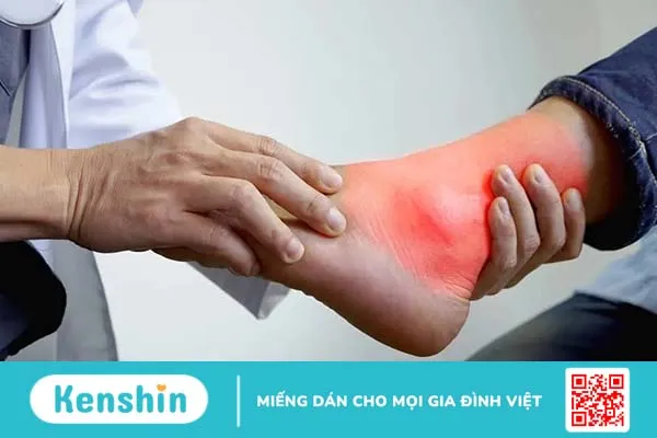Bệnh gút cấp dùng thuốc giảm đau gì? Bệnh gút cấp dùng thuốc giảm đau gì?