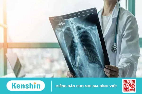 Bệnh lao xương có lây không?