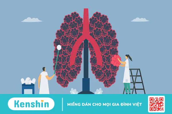 Bệnh phổi tắc nghẽn mạn tính sống được bao lâu đối với mỗi giai đoạn?