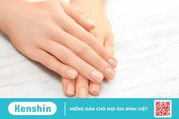 Bệnh vảy nến móng tay: Triệu chứng và cách điều trị