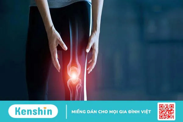 Bệnh viêm xương khớp: Những thông tin bạn cần biết