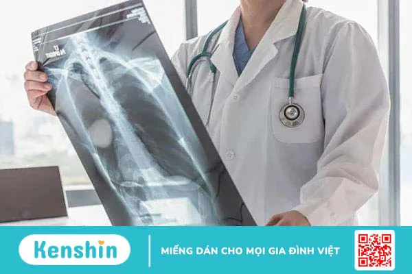 Bệnh xơ phổi có lây không? Nguyên nhân và sống cùng bệnh