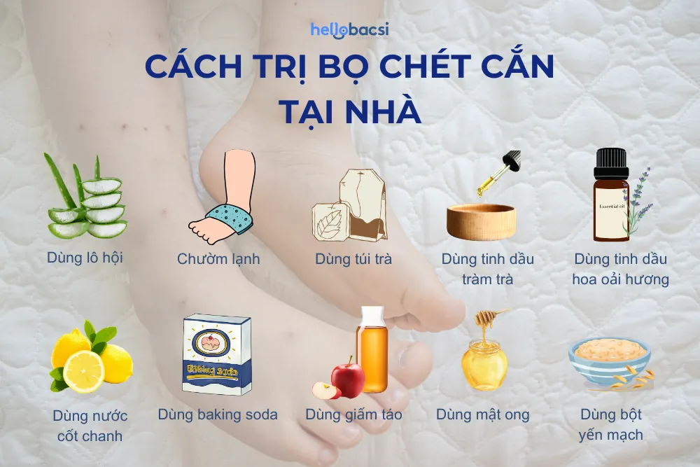 Bị bọ chét cắn có sao không? 10 cách trị an toàn, hiệu quả tại nhà cho bé