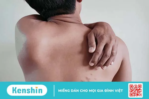 Bị đau ngực phải là bệnh gì? Đừng chủ quan với nhói ngực, tức ngực