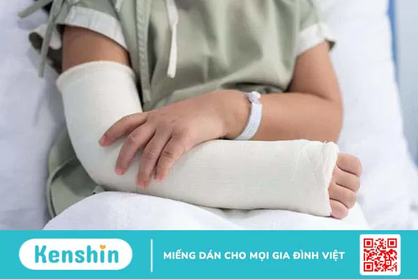 Bị gãy xương, sau 3 tuần tháo bột được chưa?