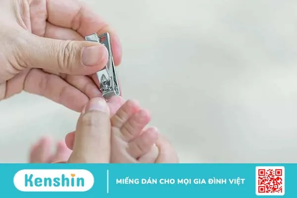 Bí quyết cắt móng tay cho trẻ sơ sinh đơn giản, an toàn