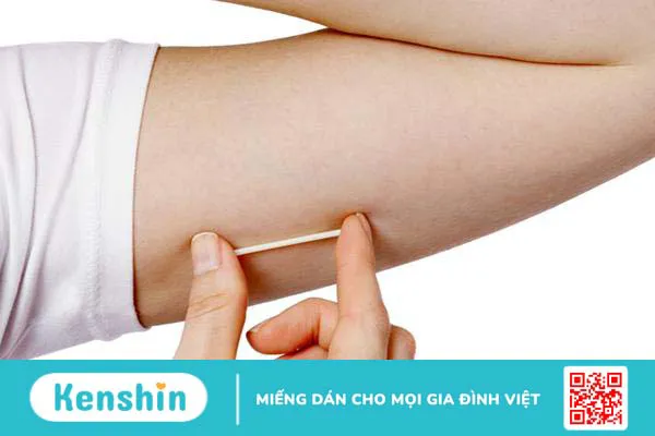 Biện pháp tránh thai sau sinh nào phù hợp cho bạn?