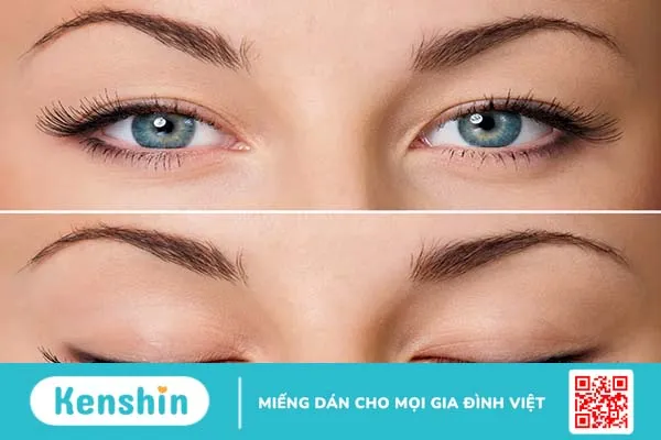 Bỏ túi 10 cách chống mỏi mắt dành cho dân văn phòng