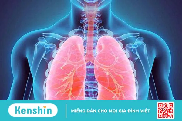 Bụi phổi: Căn bệnh thường gặp khi có nhiều bụi mịn