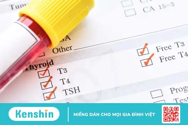 Bướu basedow gây bệnh cường giáp ở trẻ em – Làm thế nào để nhận biết?