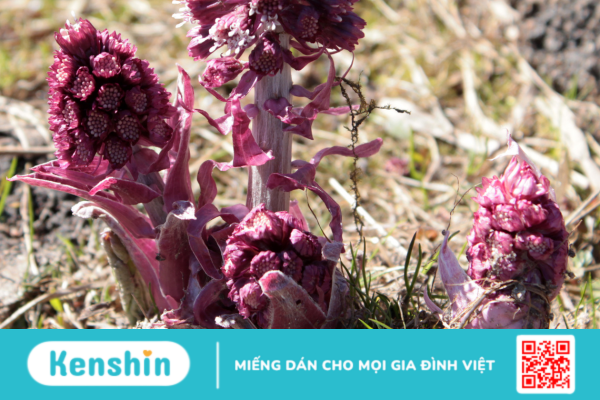 Butterbur – Thảo dược thần kì chuyên trị đau nửa đầu