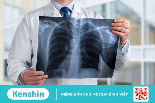 Các bệnh về phổi phổ biến nhất mà bạn nên biết