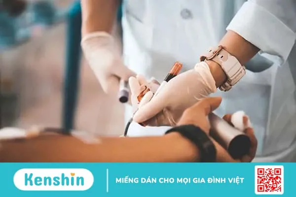 Các phương pháp điều trị bệnh tan máu bẩm sinh thể nhẹ