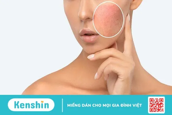 Các phương pháp trẻ hóa da bằng laser: Lựa chọn nào dành cho bạn?