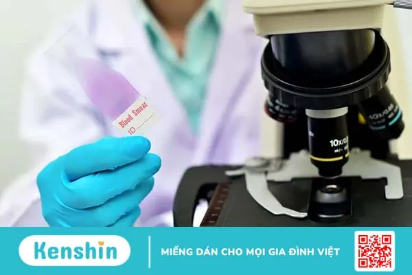 Các xét nghiệm tan máu bẩm sinh giúp chẩn đoán bệnh