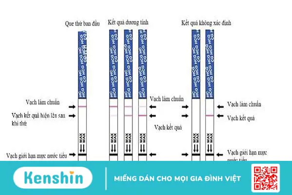 Cách dùng que thử thai và đọc kết quả que thử thai theo hướng dẫn từ bác sĩ sản khoa