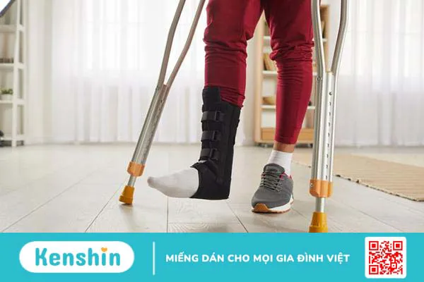 Cách tập đi sau khi bị gãy chân: Khi nào thì đi lại được?