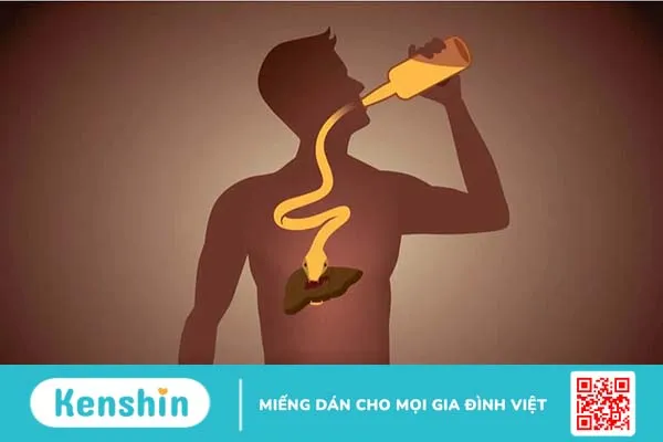 Cách tránh suy giảm chức năng gan khi vẫn phải uống rượu bia