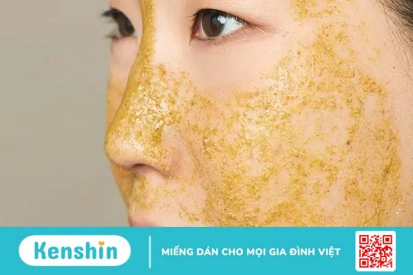 Cách trị mụn ẩn ở má đơn giản mà hiệu quả