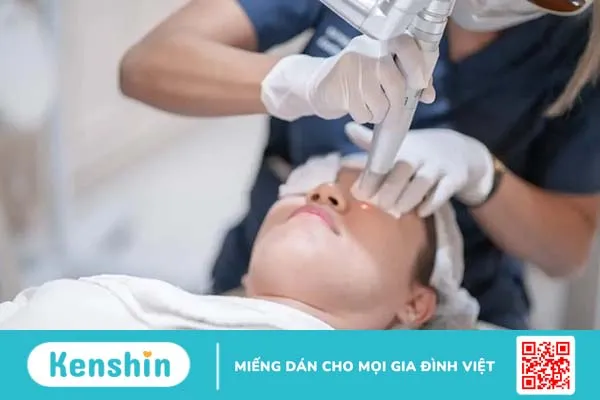 Cách trị mụn thịt trên mặt đơn giản, hiệu quả cao