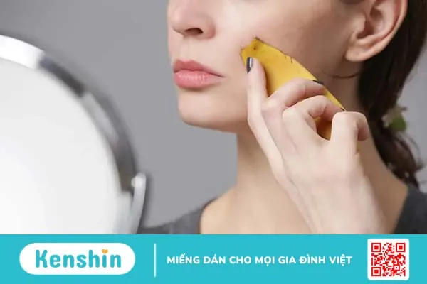 Cách trị mụn thịt trên mặt đơn giản, hiệu quả cao