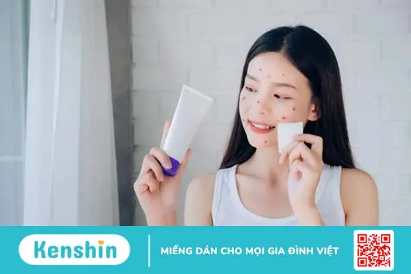 Cách trị mụn trứng cá ở tuổi dậy thì an toàn, hiệu quả tại nhà