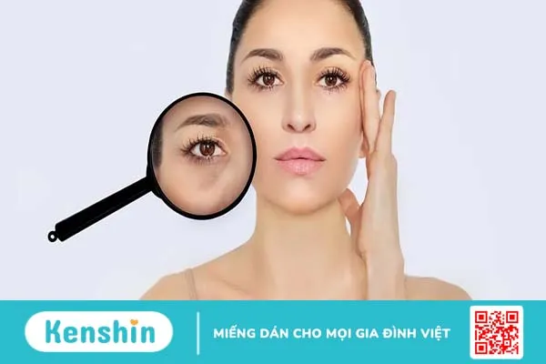 Cách trị nám tàn nhang: Làm sao để nhanh hết nám?